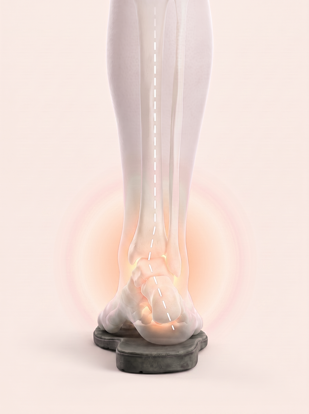 Rear view of an ankle rolling inward on a flat worn shoe sole, alignment line kinked, soft warm glow marking the unsupported joint